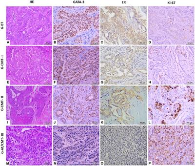GATA-3 expression and its correlation with prognostic factors and survival in canine mammary tumors